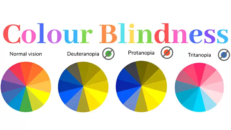 Protanomaly/Deuteranomaly